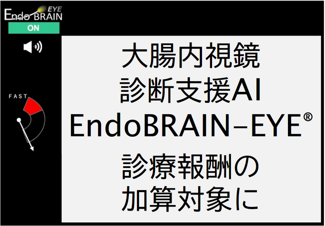 大腸内視鏡診断支援AI「EndoBRAIN-EYE(R)」が診療報酬の加算対象に